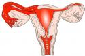 Непроходимость маточных труб: как забеременеть, как вылечить Как чистят маточные трубы у женщин